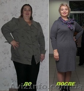 лечение ожирения - <ro>Изображение</ro><ru>Изображение</ru> #1, <ru>Объявление</ru> #805580