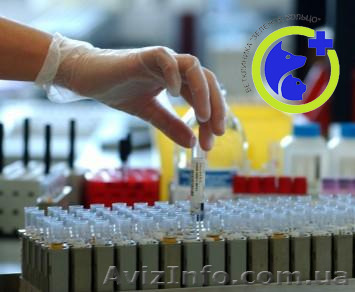 Обследование на хламидиоз - <ro>Изображение</ro><ru>Изображение</ru> #1, <ru>Объявление</ru> #1168396