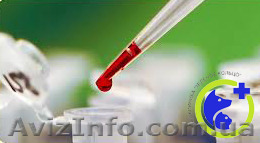 Определение титра антител к бешенству - <ro>Изображение</ro><ru>Изображение</ru> #1, <ru>Объявление</ru> #1168381