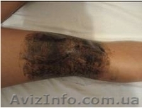 Аппликации с лечебной грязью Сакского озера  - <ro>Изображение</ro><ru>Изображение</ru> #1, <ru>Объявление</ru> #531405