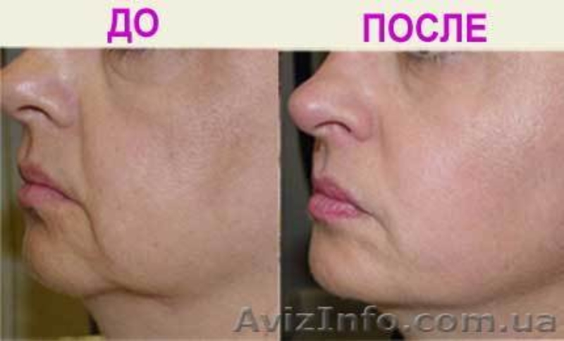 Подтяжка лица Маска Скиндалженс Skindulgence (E’Sensati - <ro>Изображение</ro><ru>Изображение</ru> #2, <ru>Объявление</ru> #76083