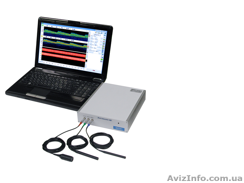 Кардиограф CardioTest Запорожье - <ro>Изображение</ro><ru>Изображение</ru> #6, <ru>Объявление</ru> #1047746