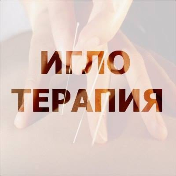 Иглоукалывание. Рефлексотерапя. Акупунктура. Выезд на дом. - <ro>Изображение</ro><ru>Изображение</ru> #3, <ru>Объявление</ru> #1676795