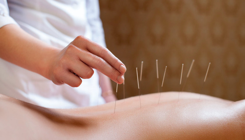 Иглоукалывание. Рефлексотерапя. Акупунктура. Выезд на дом. - <ro>Изображение</ro><ru>Изображение</ru> #2, <ru>Объявление</ru> #1676795